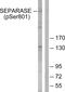 Extra Spindle Pole Bodies Like 1, Separase antibody, PA5-38245, Invitrogen Antibodies, Western Blot image 