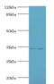 Transmembrane And Coiled-Coil Domains 5A antibody, A61342-100, Epigentek, Western Blot image 