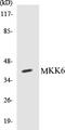 Dual specificity mitogen-activated protein kinase kinase 6 antibody, EKC1372, Boster Biological Technology, Western Blot image 