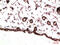 Platelet Derived Growth Factor Receptor Alpha antibody, GTX34117, GeneTex, Immunohistochemistry paraffin image 