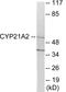 Cytochrome P450 Family 21 Subfamily A Member 2 antibody, EKC1906, Boster Biological Technology, Western Blot image 