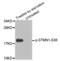 Stathmin 1 antibody, abx000273, Abbexa, Western Blot image 