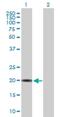 Crystallin Gamma S antibody, H00001427-B01P, Novus Biologicals, Western Blot image 