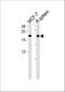 CCHC-Type Zinc Finger Nucleic Acid Binding Protein antibody, A03246, Boster Biological Technology, Western Blot image 