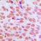 Chromobox 5 antibody, LS-C353366, Lifespan Biosciences, Immunohistochemistry frozen image 