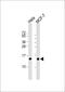 ISG15 Ubiquitin Like Modifier antibody, M00554-1, Boster Biological Technology, Western Blot image 