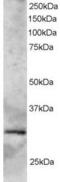 SYF2 Pre-MRNA Splicing Factor antibody, PA5-18108, Invitrogen Antibodies, Western Blot image 