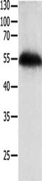 Tumor Protein P63 antibody, CSB-PA900875, Cusabio, Western Blot image 