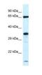 Kelch Like Family Member 12 antibody, NBP1-82404, Novus Biologicals, Western Blot image 