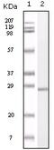 S100 Calcium Binding Protein A1 antibody, 32-213, ProSci, Enzyme Linked Immunosorbent Assay image 