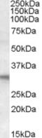 Four And A Half LIM Domains 2 antibody, EB06303, Everest Biotech, Western Blot image 