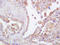 CD44 antibody, 251174, Abbiotec, Immunohistochemistry paraffin image 