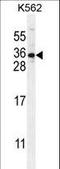 StAR Related Lipid Transfer Domain Containing 6 antibody, LS-C161547, Lifespan Biosciences, Western Blot image 