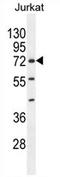 Zinc Finger Protein 648 antibody, AP54705PU-N, Origene, Western Blot image 