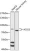 Acyl-CoA Synthetase Short Chain Family Member 2 antibody, 15-095, ProSci, Western Blot image 