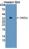 G protein-coupled receptor kinase 6 antibody, LS-C702165, Lifespan Biosciences, Western Blot image 