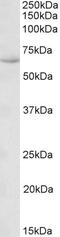 Heat Shock Protein Family A (Hsp70) Member 13 antibody, EB11978, Everest Biotech, Western Blot image 