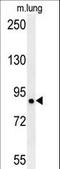 Leucine Rich Repeat Containing 4B antibody, LS-C165887, Lifespan Biosciences, Western Blot image 