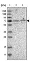 Kelch Like Family Member 20 antibody, NBP1-81559, Novus Biologicals, Western Blot image 