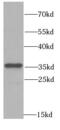 Serine/threonine-protein phosphatase 4 catalytic subunit antibody, FNab06733, FineTest, Western Blot image 