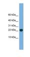 POP5 Homolog, Ribonuclease P/MRP Subunit antibody, orb326123, Biorbyt, Western Blot image 