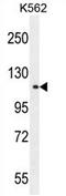 Tudor Domain Containing 1 antibody, AP54211PU-N, Origene, Western Blot image 