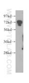 Dynein Cytoplasmic 1 Intermediate Chain 2 antibody, 12219-1-AP, Proteintech Group, Western Blot image 