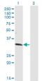 Zinc Finger Protein 101 antibody, H00094039-M01, Novus Biologicals, Western Blot image 