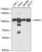 Ubiquitin Like With PHD And Ring Finger Domains 1 antibody, A01156, Boster Biological Technology, Western Blot image 