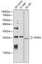 POP4 Homolog, Ribonuclease P/MRP Subunit antibody, GTX65628, GeneTex, Western Blot image 