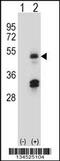 Histone acetyltransferase type B catalytic subunit antibody, 57-822, ProSci, Western Blot image 