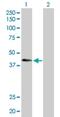 ATPase H+ Transporting V1 Subunit C2 antibody, H00245973-D01P, Novus Biologicals, Western Blot image 