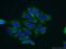 Protein Phosphatase, Mg2+/Mn2+ Dependent 1B antibody, 13193-1-AP, Proteintech Group, Immunofluorescence image 