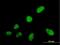 Serine And Arginine Rich Splicing Factor 5 antibody, H00006430-B02P, Novus Biologicals, Immunofluorescence image 
