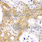 Actin Alpha 2, Smooth Muscle antibody, A7248, ABclonal Technology, Immunohistochemistry paraffin image 