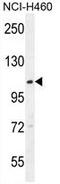 Acyl-CoA Dehydrogenase Family Member 10 antibody, AP50046PU-N, Origene, Western Blot image 