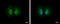 Proteasome Activator Subunit 1 antibody, GTX118374, GeneTex, Immunocytochemistry image 