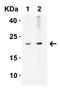 Interferon Beta 1 antibody, A02041-1, Boster Biological Technology, Western Blot image 