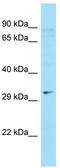Chromosome 9 Open Reading Frame 24 antibody, TA333607, Origene, Western Blot image 