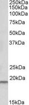 Serine Peptidase Inhibitor, Kunitz Type 2 antibody, NBP1-52068, Novus Biologicals, Western Blot image 