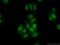 THUMP Domain Containing 1 antibody, 14921-1-AP, Proteintech Group, Immunofluorescence image 