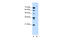 Ubiquitin Specific Peptidase 48 antibody, 31-356, ProSci, Western Blot image 