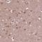 Zinc Finger Protein 292 antibody, HPA050618, Atlas Antibodies, Immunohistochemistry paraffin image 