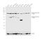 Estrogen Receptor 2 antibody, PA1-313, Invitrogen Antibodies, Western Blot image 