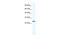 Calcium Voltage-Gated Channel Auxiliary Subunit Gamma 6 antibody, 28-284, ProSci, Western Blot image 