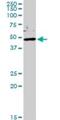 NPHS2 Stomatin Family Member, Podocin antibody, H00007827-D01P, Novus Biologicals, Western Blot image 