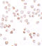 TGFB1-Induced Anti-Apoptotic Factor 1 antibody, A12896, Boster Biological Technology, Immunocytochemistry image 