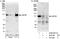 Ubiquitin Specific Peptidase 38 antibody, A300-941A, Bethyl Labs, Western Blot image 