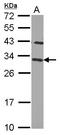 Charged multivesicular body protein 2b antibody, LS-C155299, Lifespan Biosciences, Western Blot image 