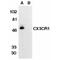 C-X3-C Motif Chemokine Receptor 1 antibody, AHP566, Bio-Rad (formerly AbD Serotec) , Western Blot image 